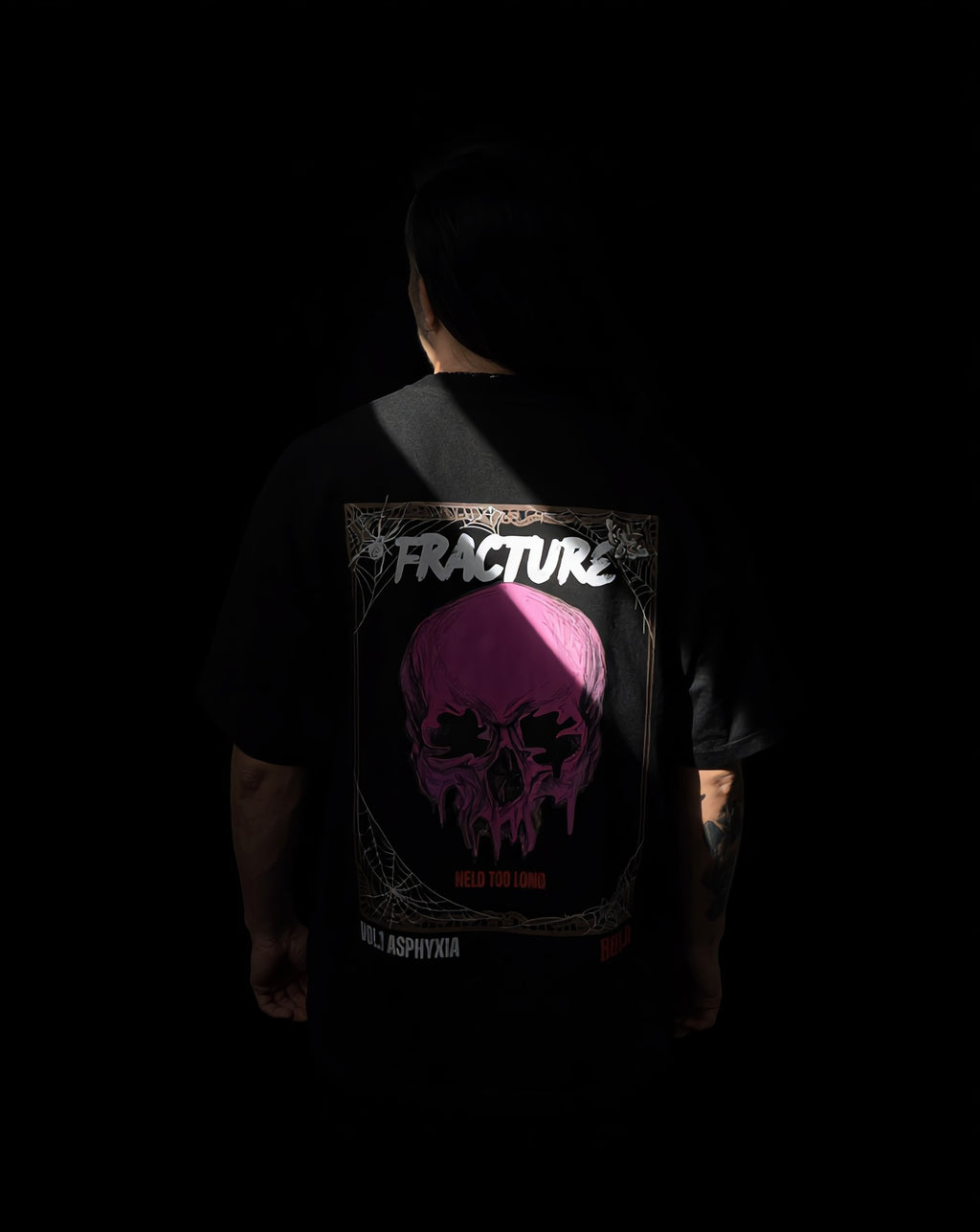 Fracture