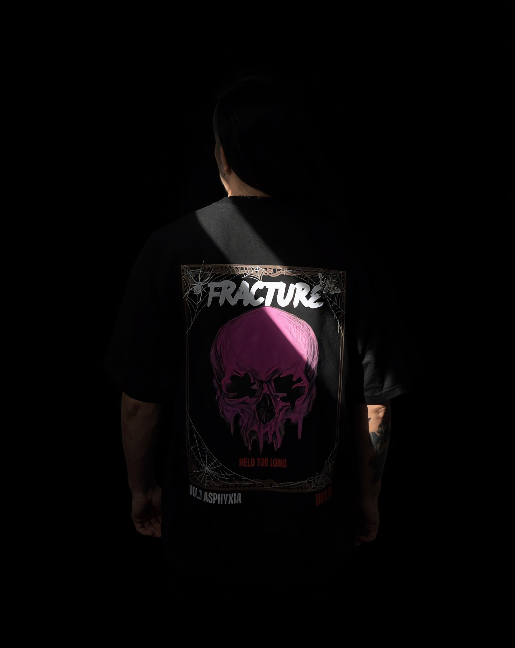 Fracture