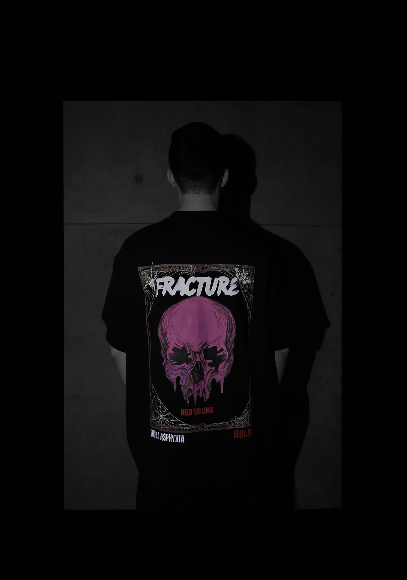 Fracture